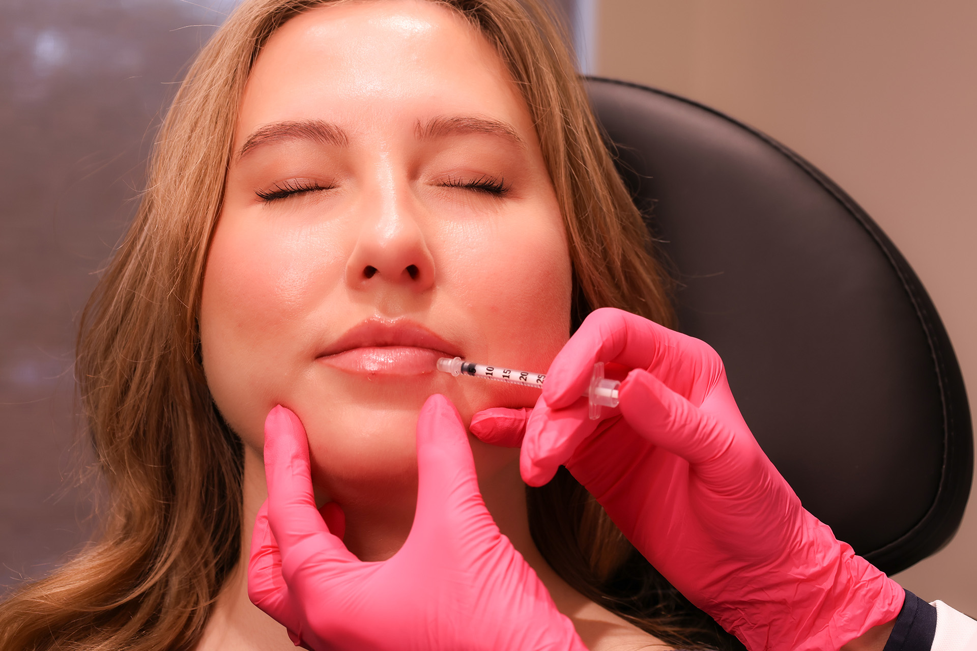 Injectable Hyaluronic Acid (Dermal Fillers) Image